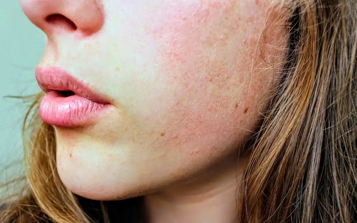 Les erreurs courantes qui nuisent à la santé de votre peau